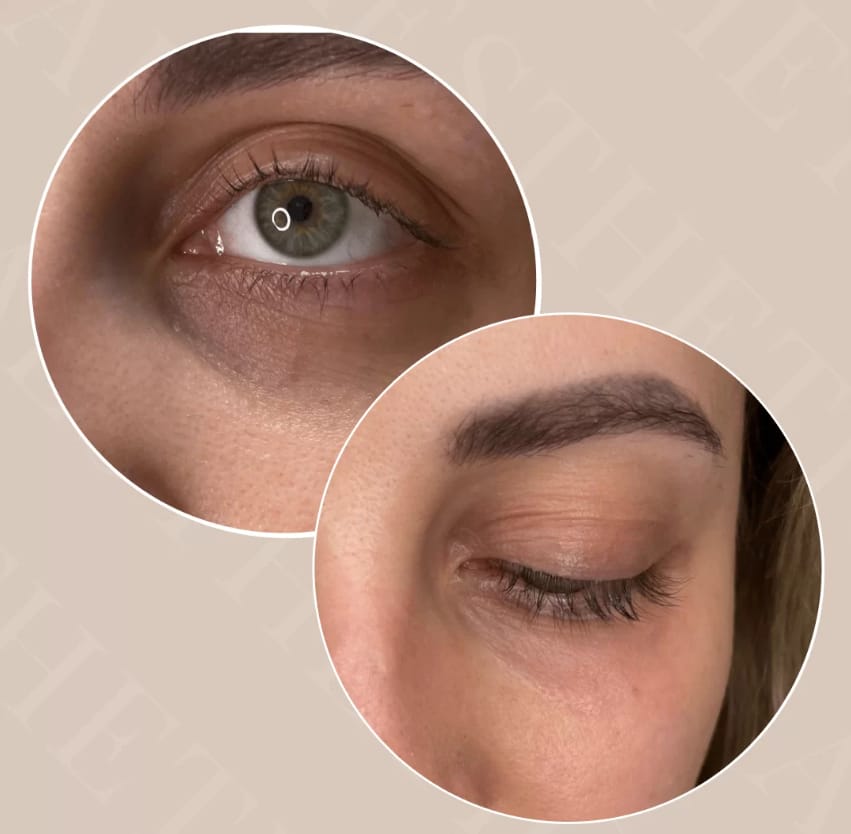 CENTRO DE ESTÉTICA PARA MICROPIGMENTACIÓN Y PLASMAPEN EN VALLADOLID