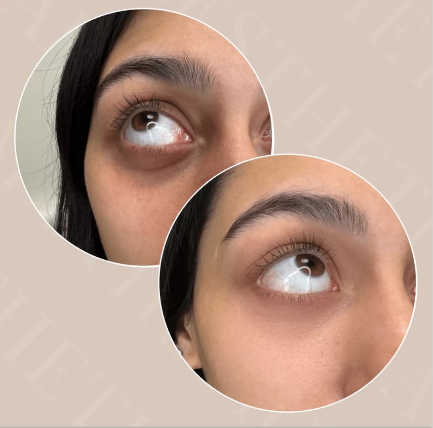 Precio de Micropigmentación de Cejas en Valladolid